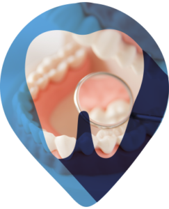 PRÓTESE
A especialidade de prótese dentária é responsável por reestruturar os tecidos bucais e dentes perdidos, seja por acidentes ou doenças periodontais, por peças artificiais – são elas fixas ou removíveis.