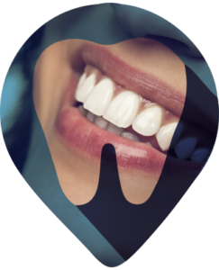 EXODONTIA
Cirurgia de exodontia , Exodontia é a remoção cirúrgica de um elemento dentário.
